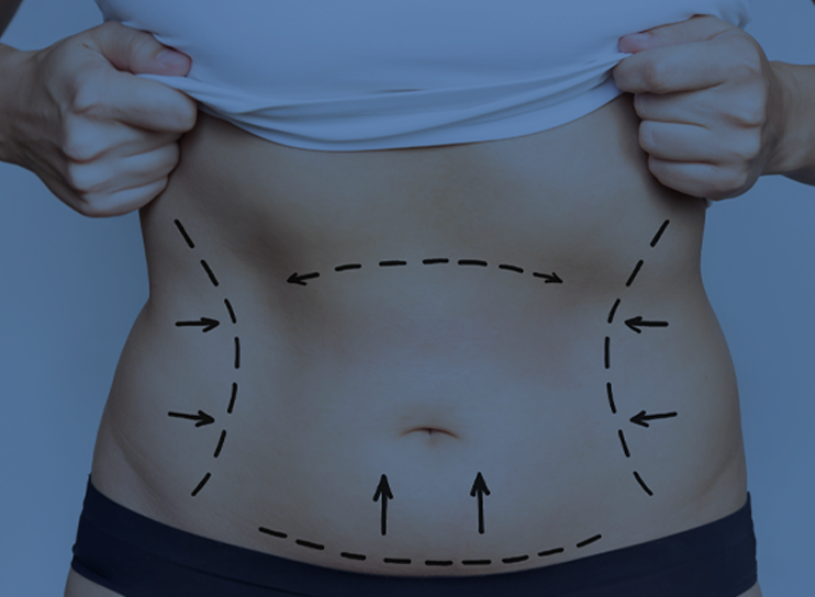 why-you-should-choose-turkey-for-bariatric-surgery